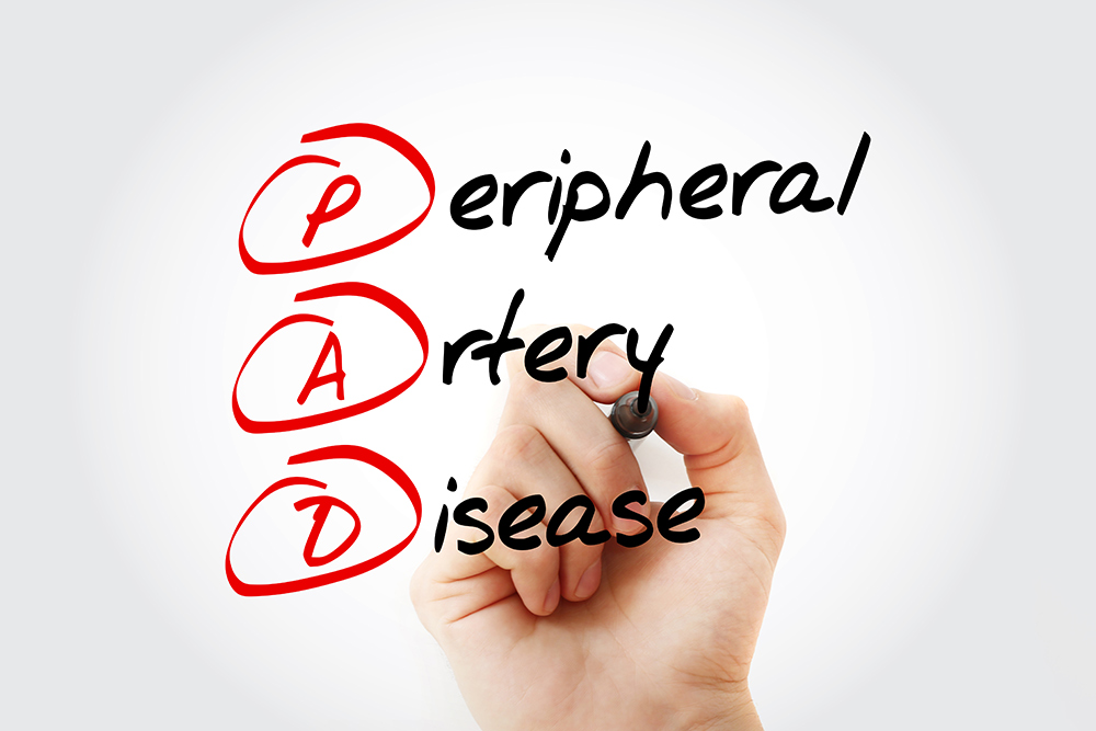 PAD - Peripheral Artery Disease acronym